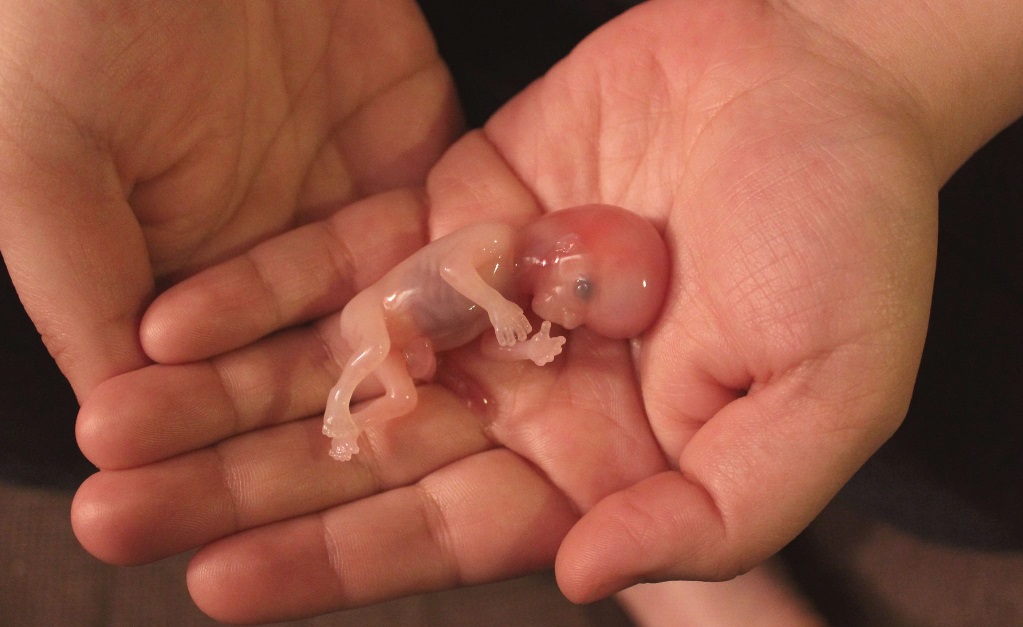 Я веду очень страшный блог» Все должны знать как выглядит аборт